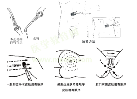 手術區(qū)消毒