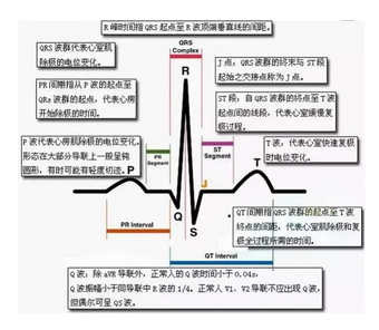 心電圖